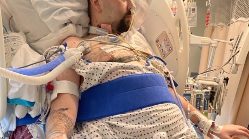 Um homem de 25 anos que teve que fazer um transplante duplo de pulmão devido ao COVID-19 disse que seus pulmões pareciam "mascar chicletes".