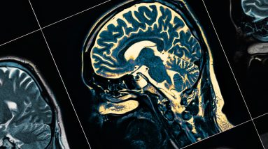 Os cientistas dizem que podem ter descoberto a causa da doença de Alzheimer