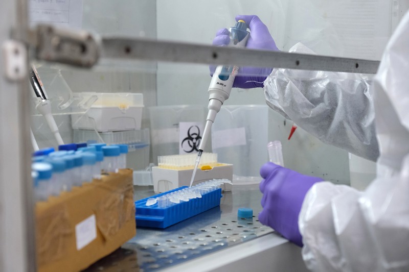 Um técnico usa um conta-gotas para extrair RNA durante um teste Covid-19 RT PCR no laboratório
