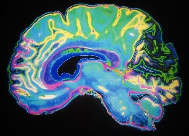 O estudo fornece pistas para a base neural da consciência