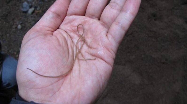 Um verme parasita “vivo e contorcido” removido do cérebro de uma mulher australiana