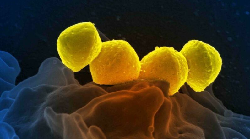 STSS: Japão registra recorde de infecções bacterianas mortais